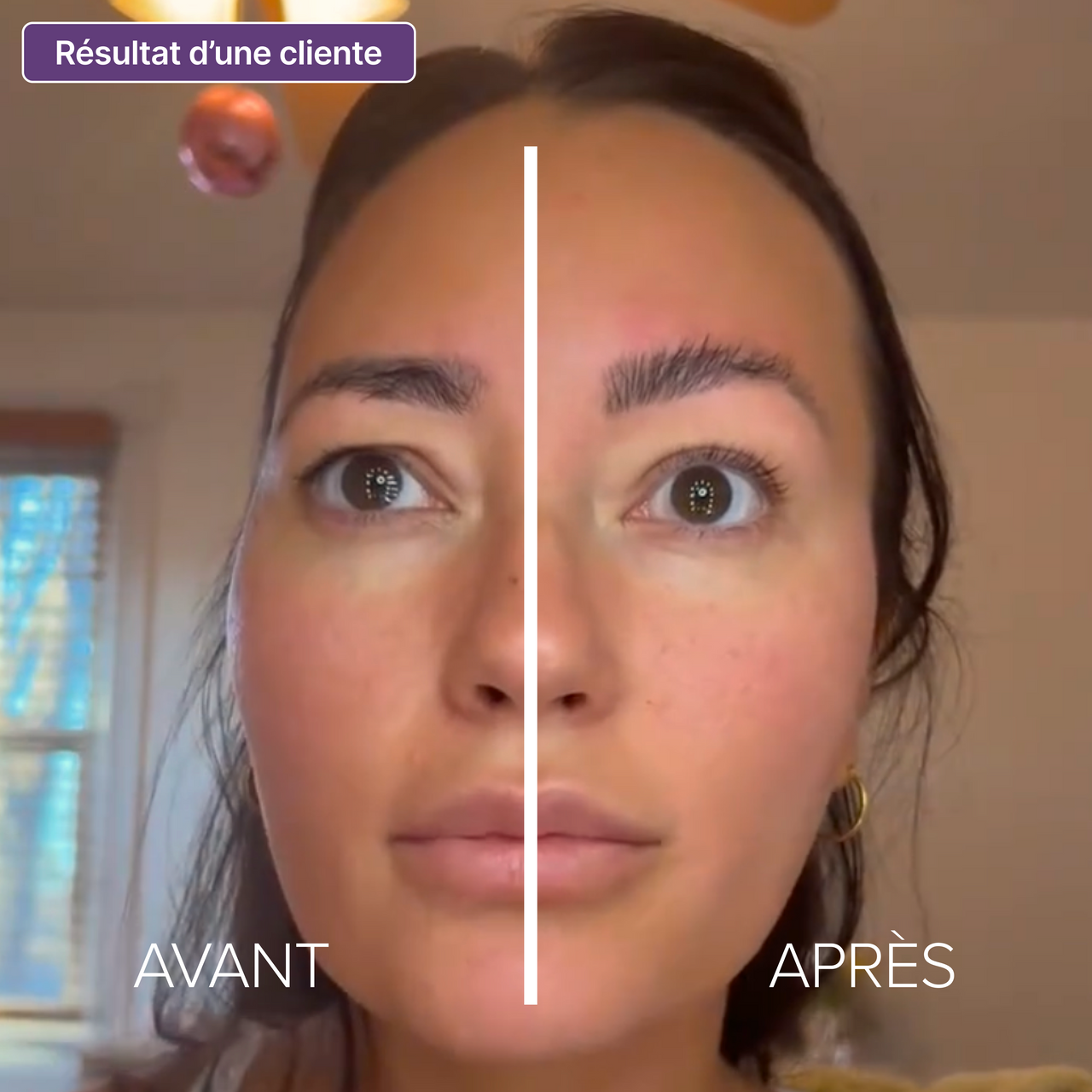 LymphaGlow™ - Redessine ton visage dès le réveil