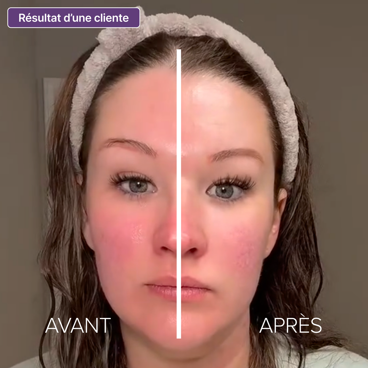 LymphaGlow™ - Redessine ton visage dès le réveil